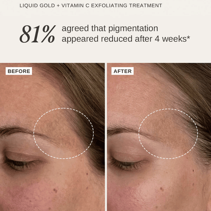 Alpha-H Liquid Gold + Vitamin C Trial Kit