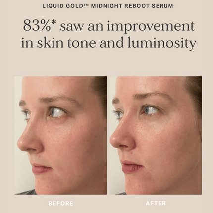 Alpha-H Midnight Reboot Serum 10ml