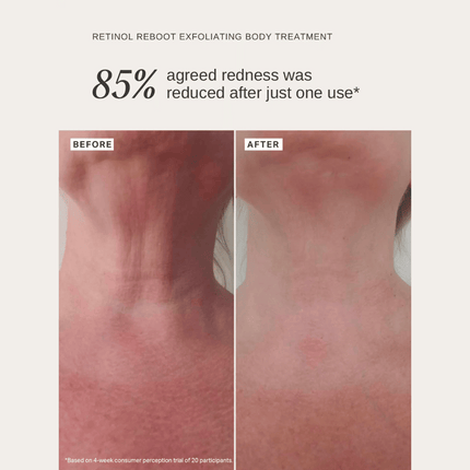 Alpha-H Retinol Reboot Exfoliating Body Treatment 120ml