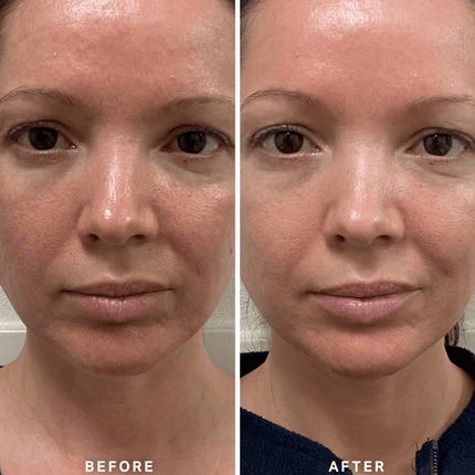 Alpha-H Vitamin B Serum with 5% Niacinamide 10ml