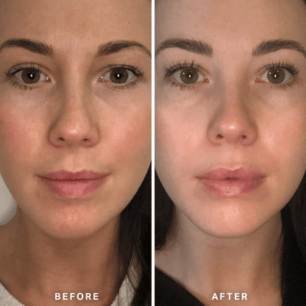 Alpha-H Vitamin B Serum 25ml