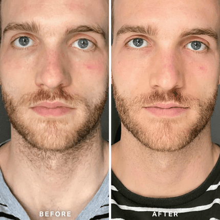 Alpha-H Vitamin B Serum 25ml