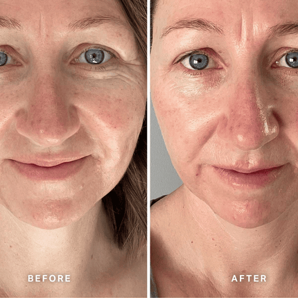 Alpha-H Vitamin E Serum 25ml