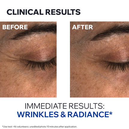 Uriage Age Absolu Eye Contour 15ml