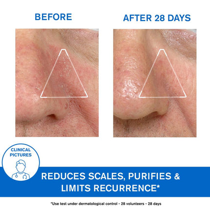 Uriage D.S. Regulating Emulsion, Irritation, Redness, Scales 40ml