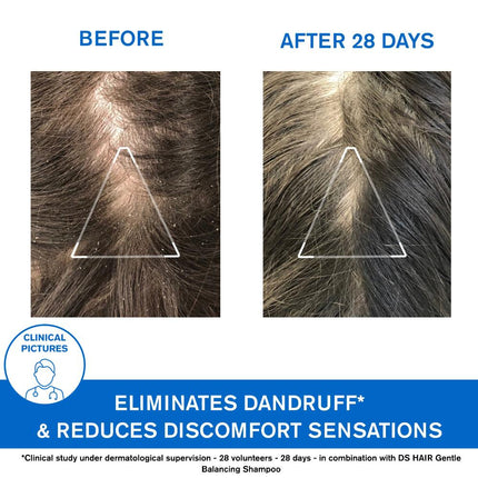 Uriage D.S. Hair Soft Balancing Shampoo Duo 2x500ml