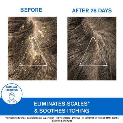 Uriage D.S. Lotion Regulating Soothing Spray 100ml