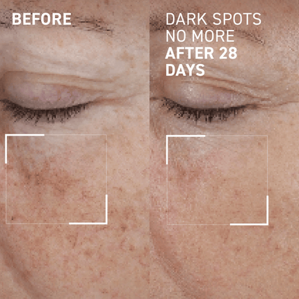 Dr Brandt Dark Spots No More Serum 15ml