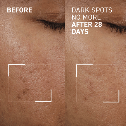 Dr Brandt Dark Spots No More Serum 15ml