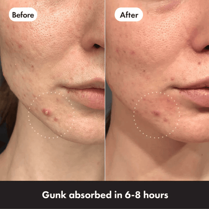 Hero Mighty Patch Duo