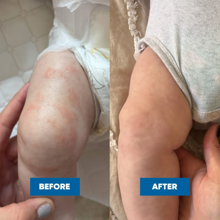 MooGoo Pink Eczema Cream 120g