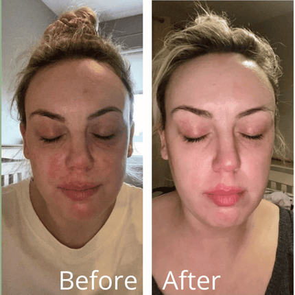 Sasta Microbiome Booster Serum 30ml